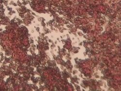 Blood flow Stock Footage