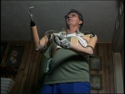 Amputee tests 'bionic' thought-controlled artificial arm News Clip