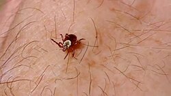 Hungry tick Stock Footage