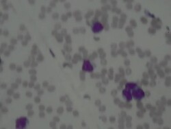 Blood cells Stock Footage