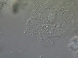 Detached epithelial cells from Human tongue scrape, with various types of swimming bacteria. Nomarski Differential Interference Contrast, horizontal field of view 180 micrometres Stock Footage