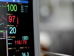 Vital Signs Monitor Stock Footage