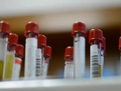 centrifuge blood tube Stock Footage