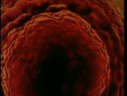 MS zooming in, Red larval effect from above Stock Footage