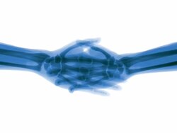 Slow X-ray handshake on white background Stock Footage
