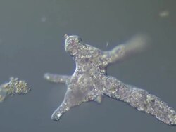 Amoeba engulfing detritus.  Good movement of granular content and pseudopodia Stock Footage