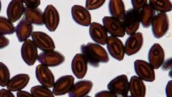 Butterflies And Bats Reveal Clues About Spread Of Infectious Disease Instructional Video