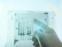 DNA genetic analysis results Stock Footage
