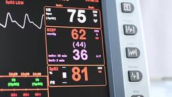 Vital signs Alert Stock Footage