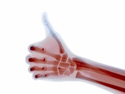 Red X-ray thumbs up Stock Footage