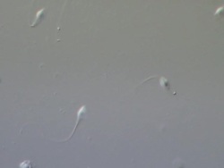 Human sperm swimming, Interference contrast Stock Footage