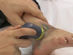 Close up of injured womans leg Stock Footage