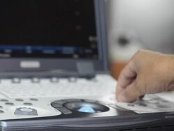 Ultrasound Stock Footage