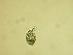 Microorganism Stock Footage