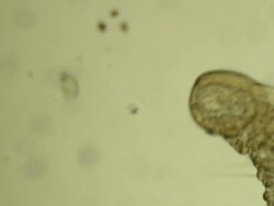 Microscopic worm crawls Stock Footage