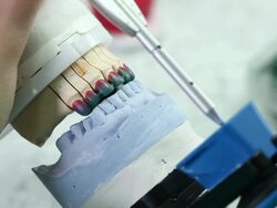 Dental prosthesis Stock Footage