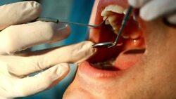 Dental check. Stock Footage