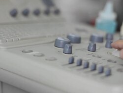 Ultrasound Stock Footage