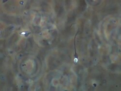 Single Human sperm swimming, noisy background, Phase contrast Stock Footage