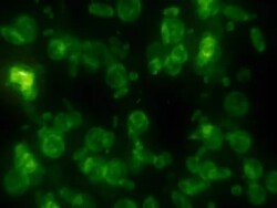 Bacteria microbe Stock Footage