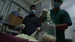 CLEAN : Under siege Syria doctors forced to improvise care News Clip