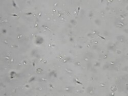 Human sperm, microscope magnification Stock Footage