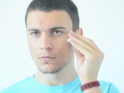 Young man squeezing pimple, isolated on white Stock Footage