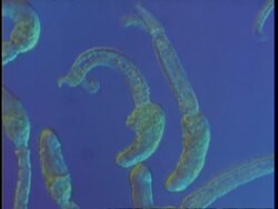 Microscopi,c tracking across cercarial stage Schistosoma mansoni, interference contrast illumination Stock Footage