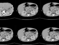 CAT and MRI Scan Stock Footage