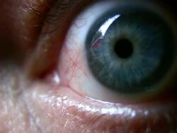HD 1080i Closeup of Eyeball 1 Stock Footage