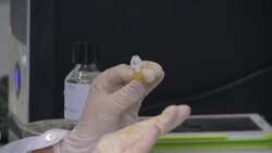 Gluten friendly flour may help coeliac sufferers News Clip