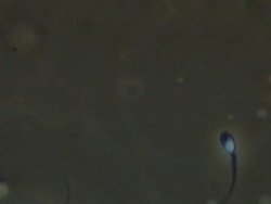 Single Human sperm swims up through frame, Phase contrast Stock Footage