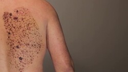 unusual mole Stock Footage