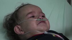 Sick Venezuelan migrants put strain on Colombia's healthcare system Instructional Video