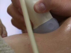 Anonymous ultrasound scan News Clip