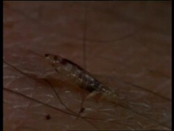 CU sequence of Head lice feeding, shows blood inside gut, United Kingdom; SEQUENCE OF CLIPS, SPECIAL TERMS APPLY Stock Footage