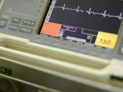 defibrillator Stock Footage