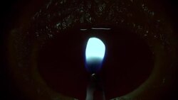 candle tungsten cu Stock Footage