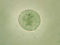 Microorganism - Volvox Stock Footage