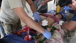 CLEAN : Civilians flee western Mosul amid fighting despite wounds News Clip