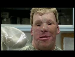 Master Sgt. Todd Nelson was injured while serving in Afghanistan. Three years later, Nelson is now receiving some state of the art facial prothetics, including a new ear. Video essay by Eric Gay. Instructional Video