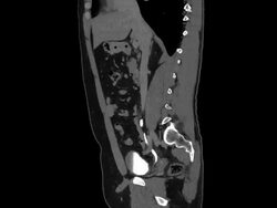 Thorax CAT Scan Stock Footage