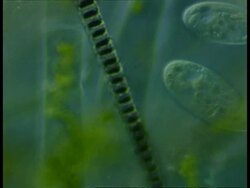Microscopic view of Ciliates and filamentous algae in background Stock Footage