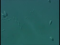 Microscopic view of Flagellates and spirochaeta bacteria, Differential Interference Contrast Stock Footage