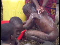 Zaire - Dysentry biggest threat in refugee camps News Clip