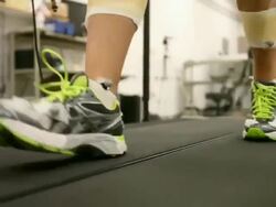 BU studies ways to prevent joint damage Stock Footage