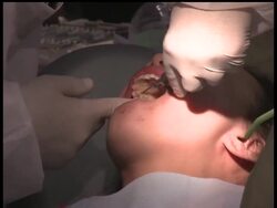 Hundreds of Los Angeles residents began lining up before dawn Wednesday to receive free medical care from a nonprofit group that will be operating here for the next seven days. News Clip