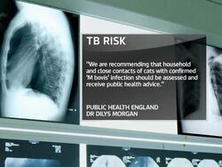 Tuberculosis found to transfer from cats to humans News Clip