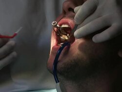 Dentist at work Stock Footage