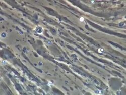 Human sperm swept along in ejaculate Stock Footage